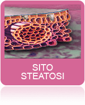 Sito Steatosi