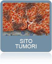 Sito Tumori